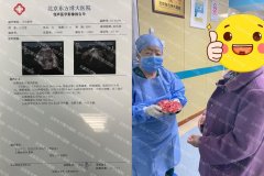 孙爱达巧手施救腺肌症，腺肌症保宫术再建新功